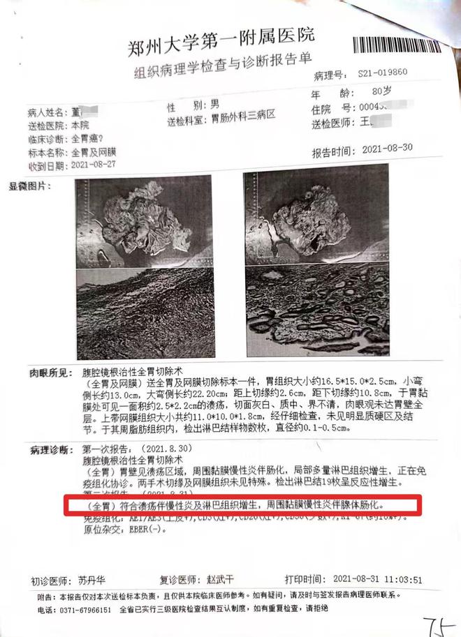 老汉患慢性胃炎，医生竟按胃癌晚期切除全胃，事发郑州，详情曝出